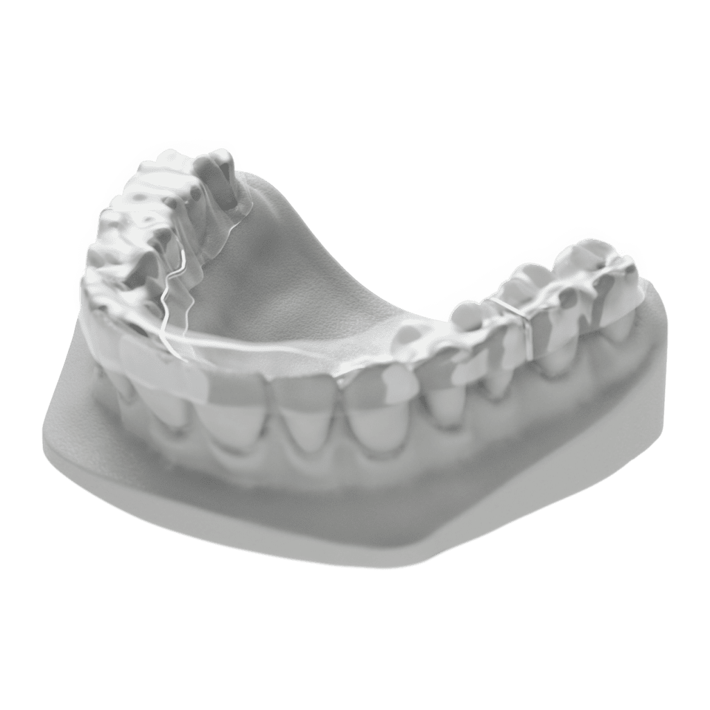 Digital Deprogramming Splint | ODL Orthodontic Labs