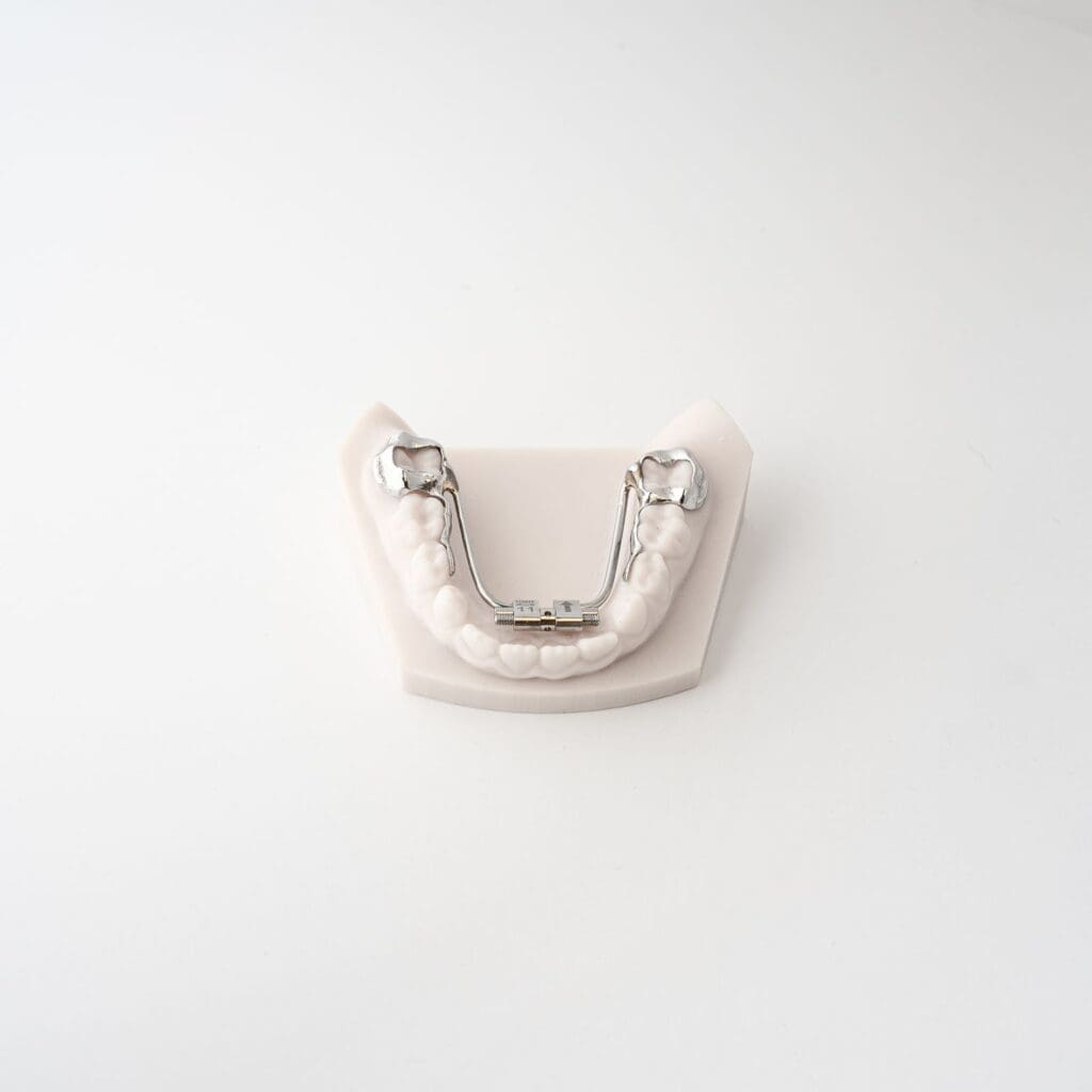 Lower Rapid Palatal Expander (RPE) 3