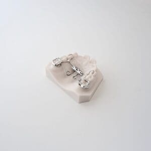 MDA (Mini Distalizing Appliance) 4
