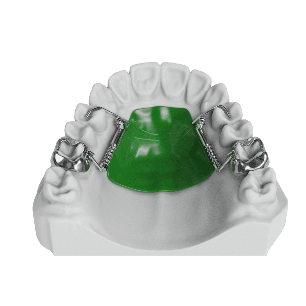 ODL DistalJet Top 010001