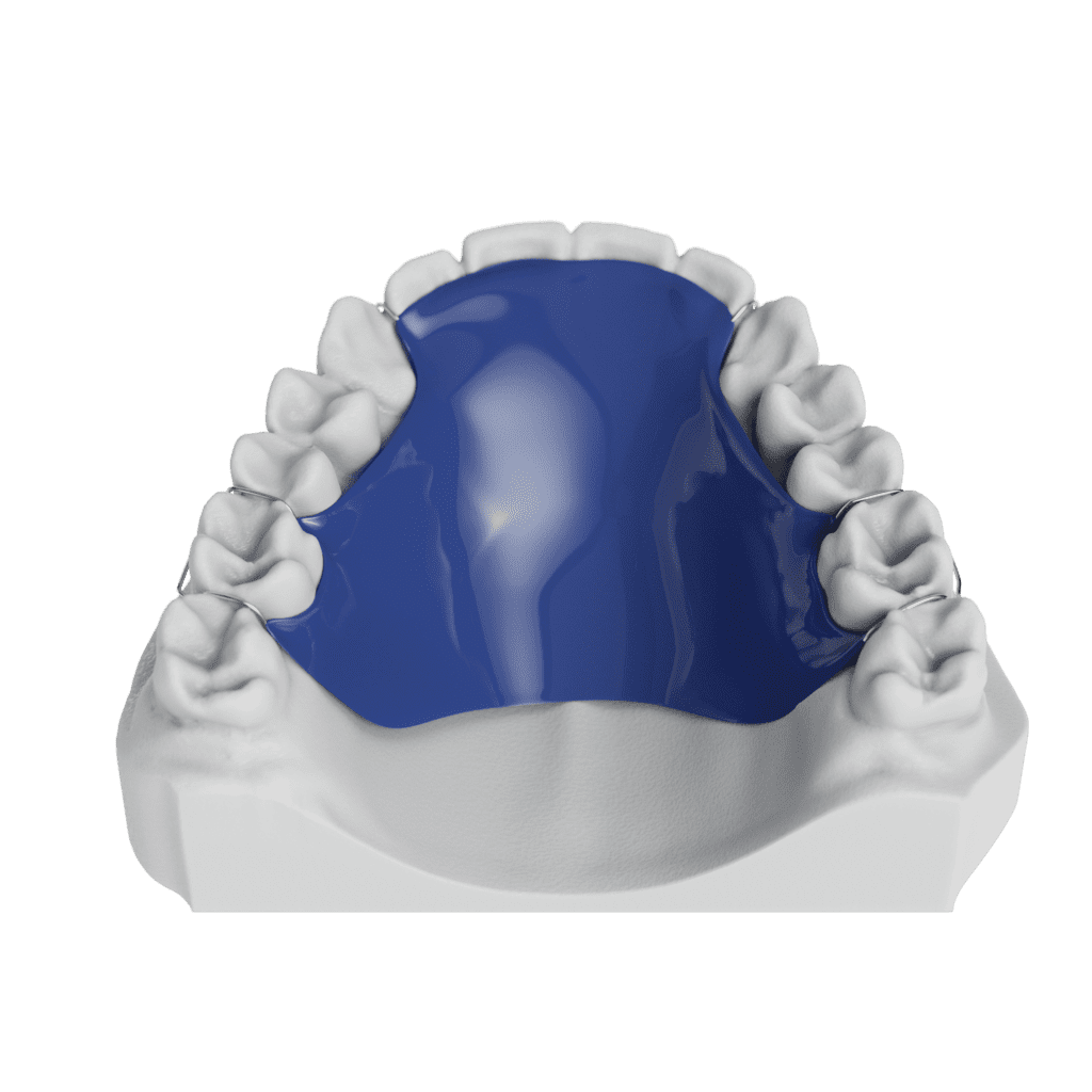 ODL Phase 1 Retainer Top 010001