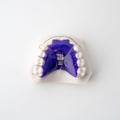 Digital Deprogramming Splint | ODL Orthodontic Labs