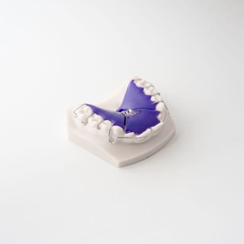 Digital Deprogramming Splint | ODL Orthodontic Labs