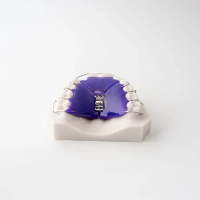 Digital Deprogramming Splint | ODL Orthodontic Labs