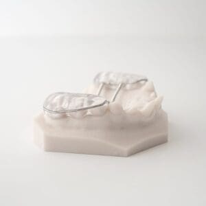 ODL Products 2024 Bonded RPE (Rapid Palatal Expander) 2