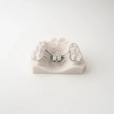 Palatal Expansion | ODL Orthodontic Labs