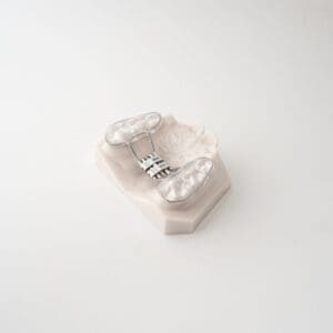 ODL Products 2024 Bonded RPE (Rapid Palatal Expander) 5