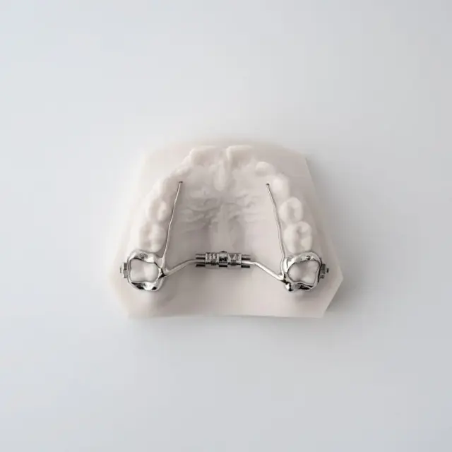 Compact RPE (Rapid Palatal Expander) | ODL Orthodontic Labs