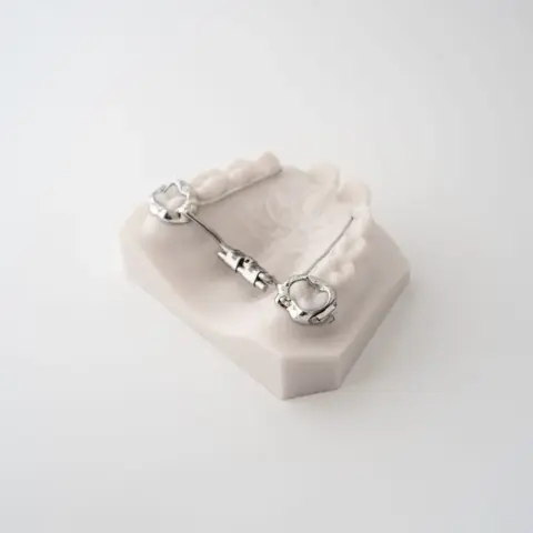 Compact RPE (Rapid Palatal Expander) | ODL Orthodontic Labs