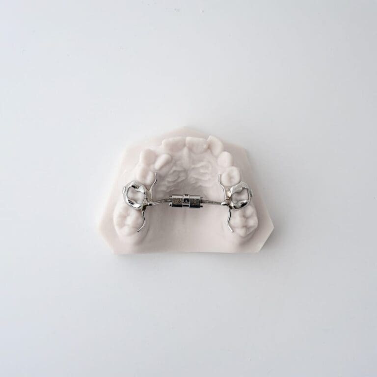 Compact RPE (Rapid Palatal Expander) | ODL Orthodontic Labs
