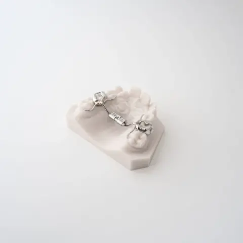 Compact RPE (Rapid Palatal Expander) | ODL Orthodontic Labs