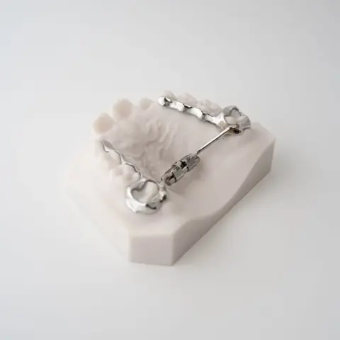 Compact RPE (Rapid Palatal Expander) | ODL Orthodontic Labs