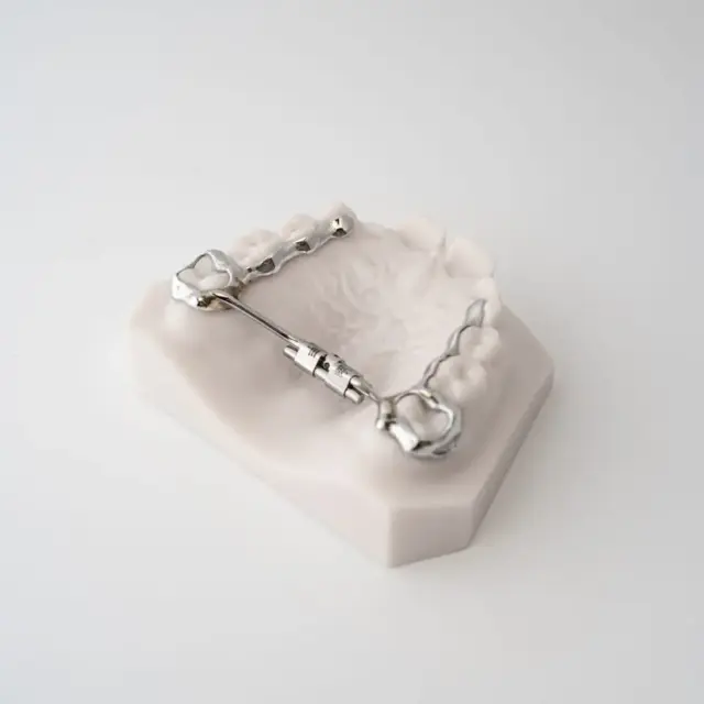 Compact RPE (Rapid Palatal Expander) | ODL Orthodontic Labs