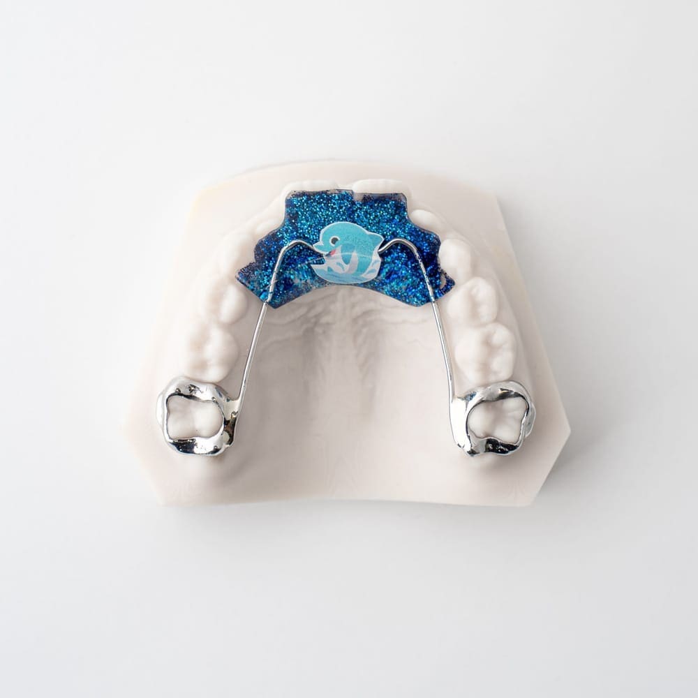 Digital Deprogramming Splint | ODL Orthodontic Labs