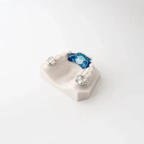 Digital Deprogramming Splint | ODL Orthodontic Labs