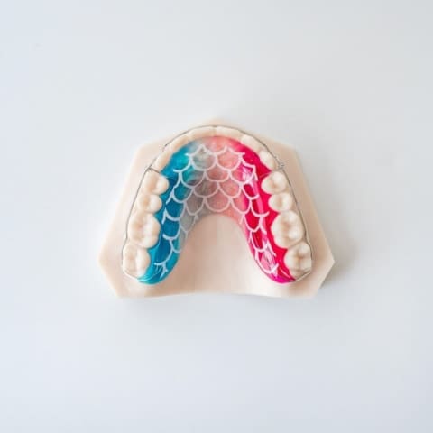 Hawley Wraparound | ODL Orthodontic Labs