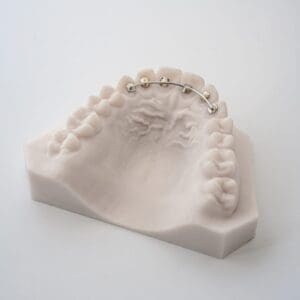 ODL Products 2024 Krouse Retainer 1