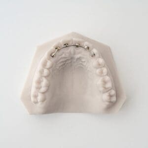 ODL Products 2024 Krouse Retainer 2