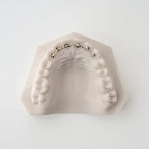MSE Tad Expander | ODL Orthodontic Labs