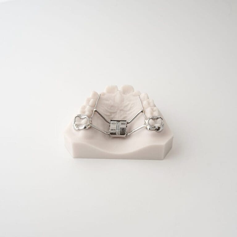 Leaf Spring Self Activated Expander | ODL Orthodontic Labs