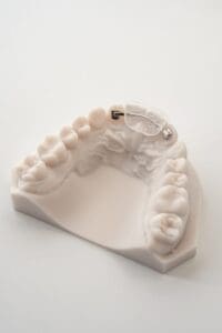 ODL Products 2024 Lingual Bonded Retainer 1