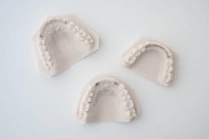 ODL Products 2024 Lingual Bonded Retainer 3