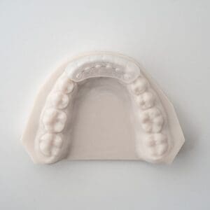 ODL Products 2024 Lingual Bonded Retainer w Custom Pads and Transfer Tray 1