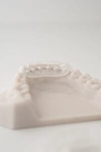 ODL Products 2024 Lingual Bonded Retainer w Custom Pads and Transfer Tray 2