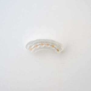 ODL Products 2024 Lingual Bonded Retainer w Custom Pads and Transfer Tray 3