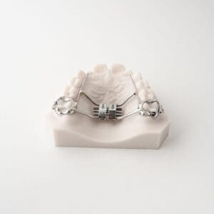 ODL Products 2024 Rapid Palatal Expander (RPE) 2