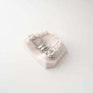 ODL Products 2024 Rapid Palatal Expander (RPE) 4