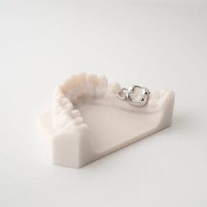 ODL Products 2024 Space Maintainer (Band and Loop) 3