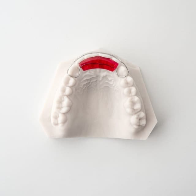 Spring Aligners & Small Movements | ODL Orthodontic Labs