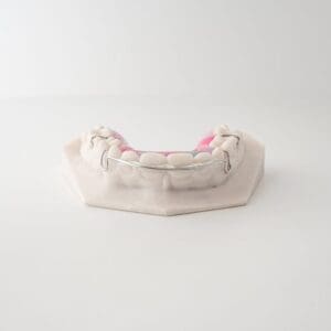 ODL Products 2024 Super Spring Aligner 3