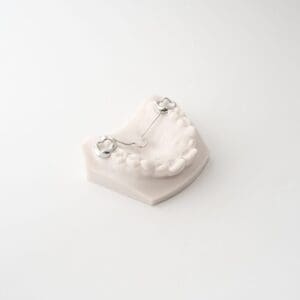 ODL Products 2024 TPA (Transpalatal Arch) 3