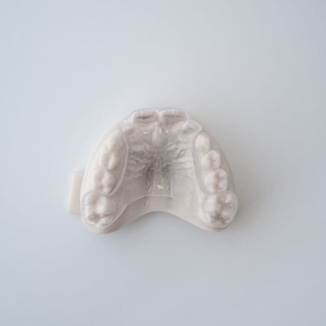 Thero Retainer Theroux Phase 1 Retainer | ODL Orthodontic Labs