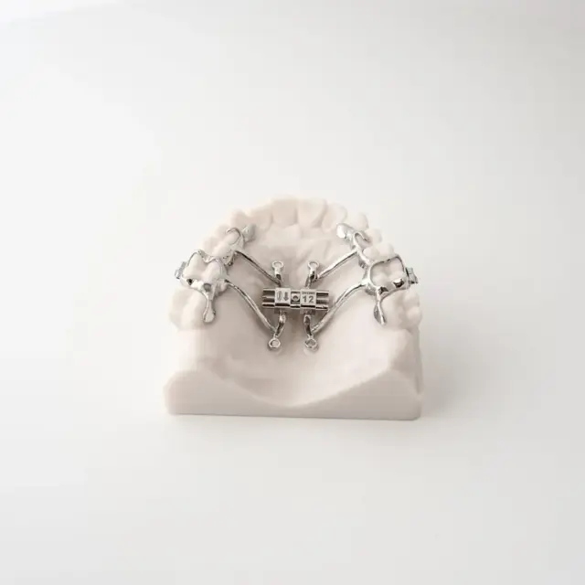 Tomas Tad Expander | ODL Orthodontic Labs