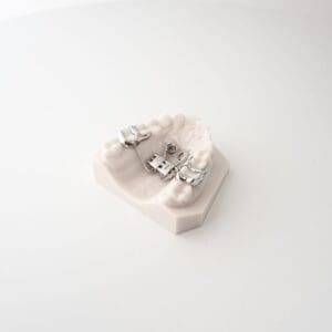 ODL Products 2024 Tomas Tad Expander w Tomas Eyelet 4