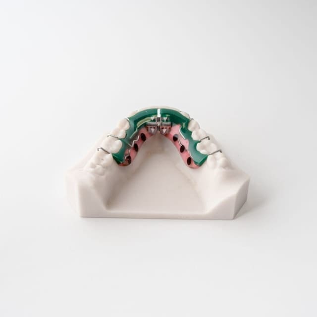 Digital Anterior Repositioning Splint | ODL Orthodontic Labs