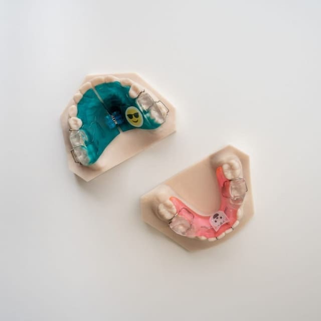 Bionator 1 & 2 | ODL Orthodontic Labs