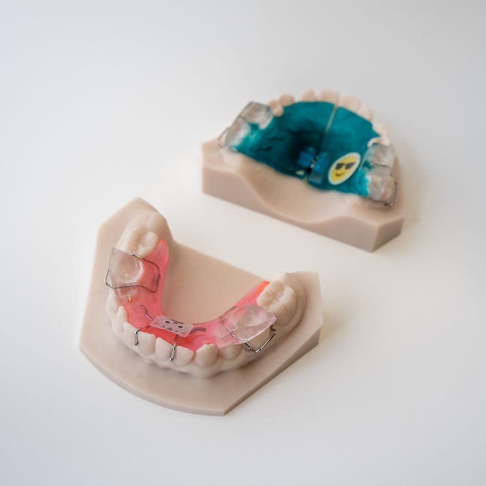 Digital Deprogramming Splint | ODL Orthodontic Labs
