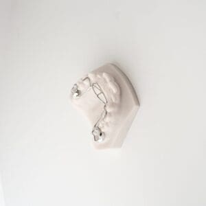 ODL Products 2024 Vertical Tongue Crib 4(1)