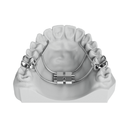 Compact RPE (Rapid Palatal Expander) | ODL Orthodontic Labs
