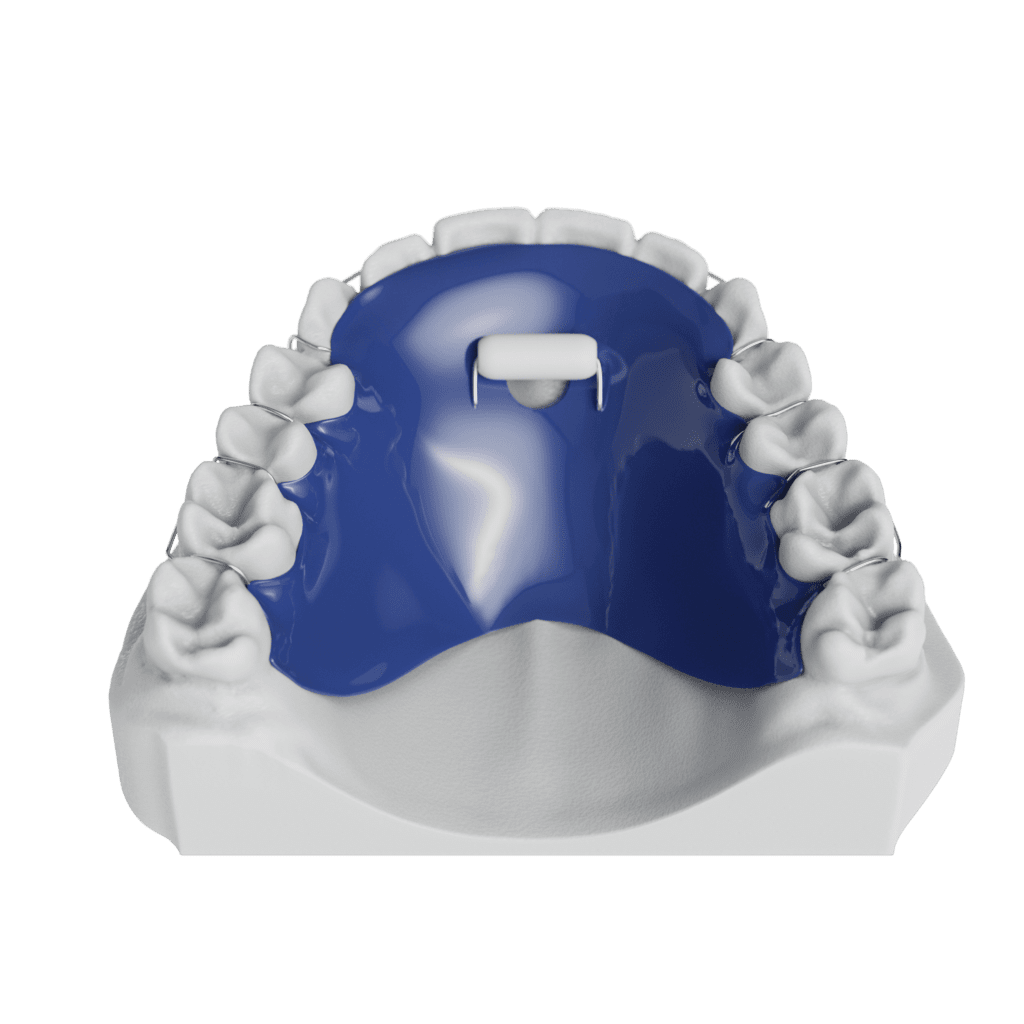 ODL Retainer With Tongue Hole And Bluegrass Top 010001