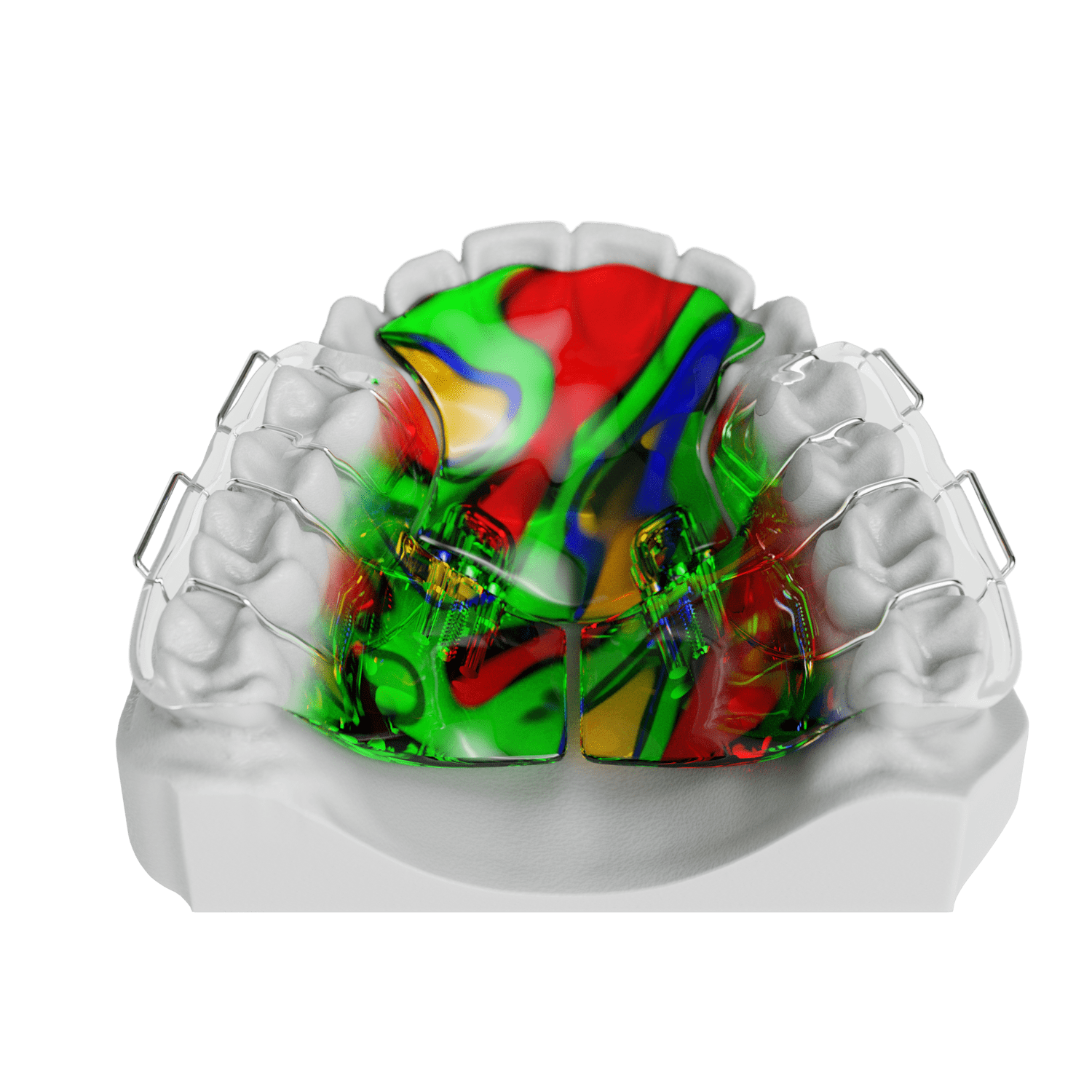 Mara Appliance ODL Orthodontic Labs