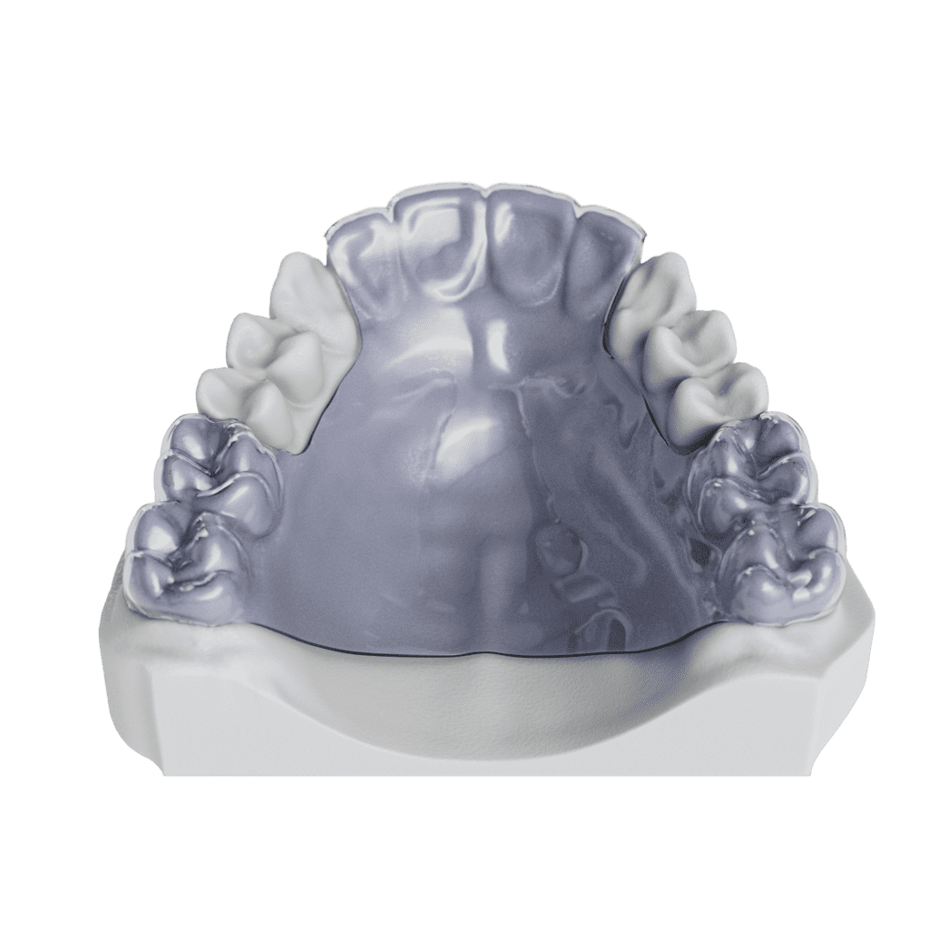 ODL TherouxPhase1Retainer Top 010001