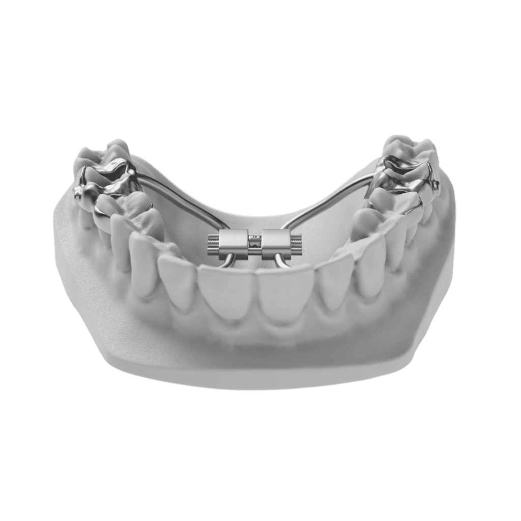 ODL Tomas Tad Expander Front 010001
