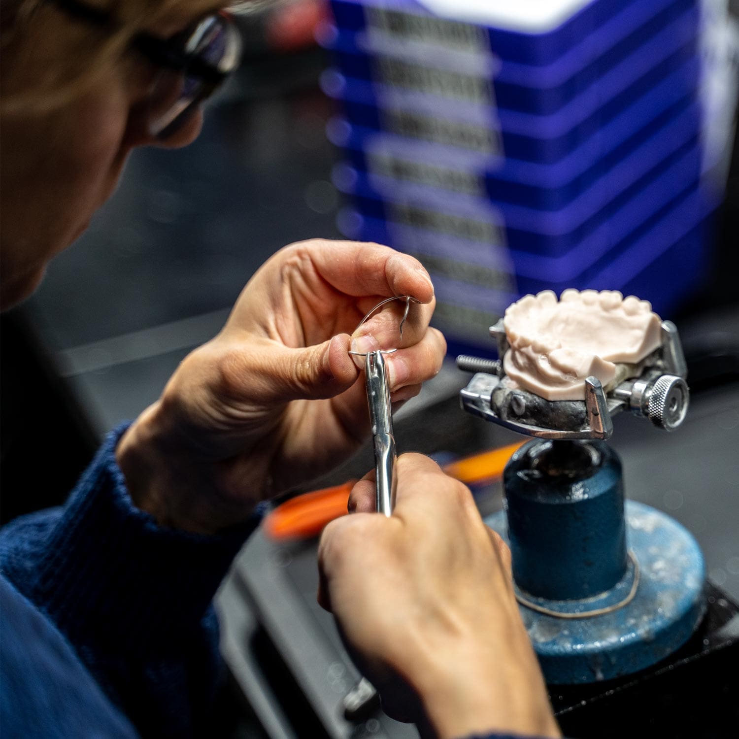 Digital Deprogramming Splint | ODL Orthodontic Labs