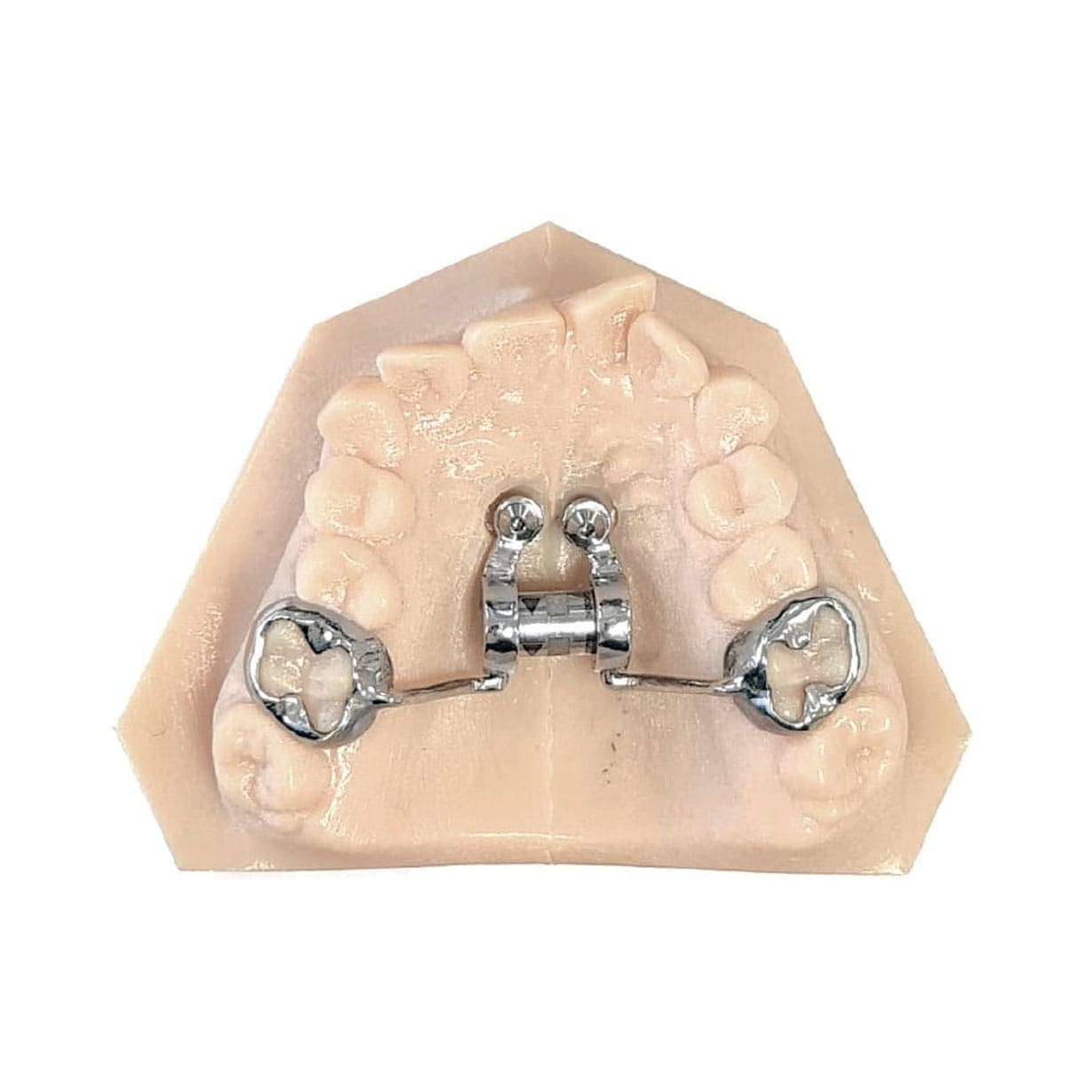 MARPE Appliances (Airway)