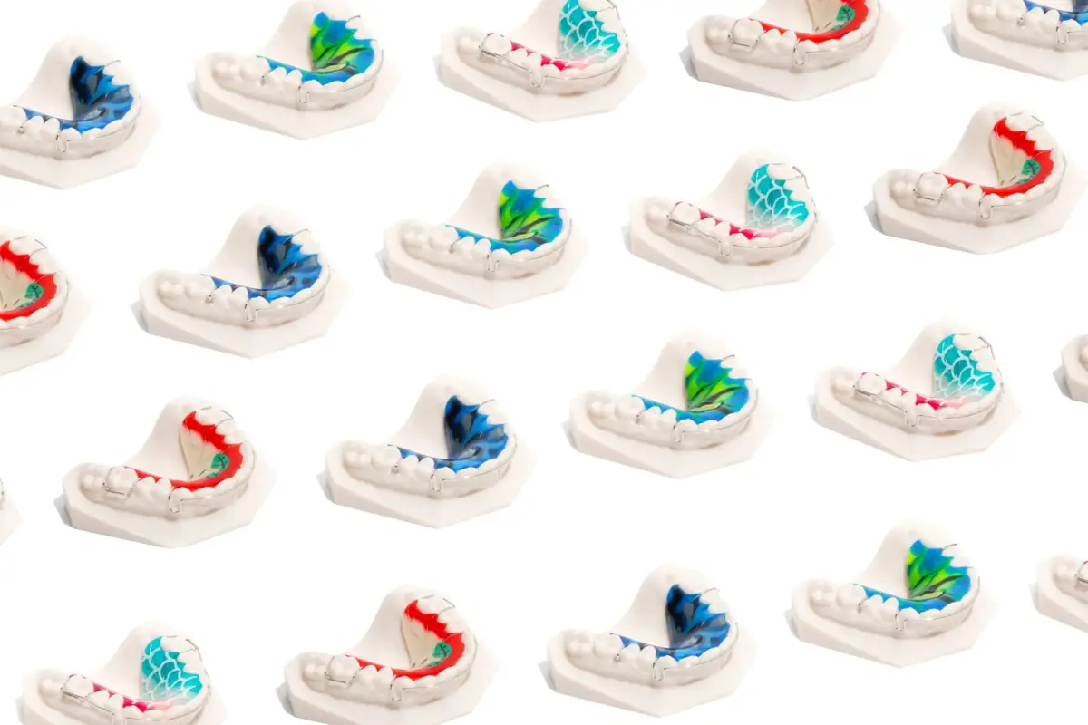 Compact RPE (Rapid Palatal Expander) | ODL Orthodontic Labs